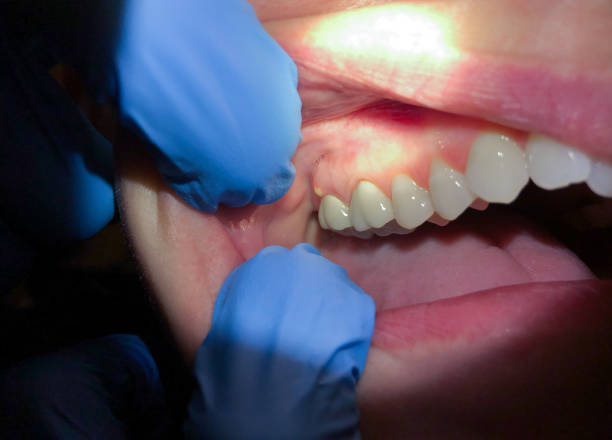Best Emergency Care for Gum Disease in Rio Verde, AZ