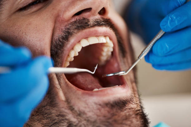 Best Knocked-Out Tooth (Avulsed Tooth) Treatment in Rio Verde, AZ